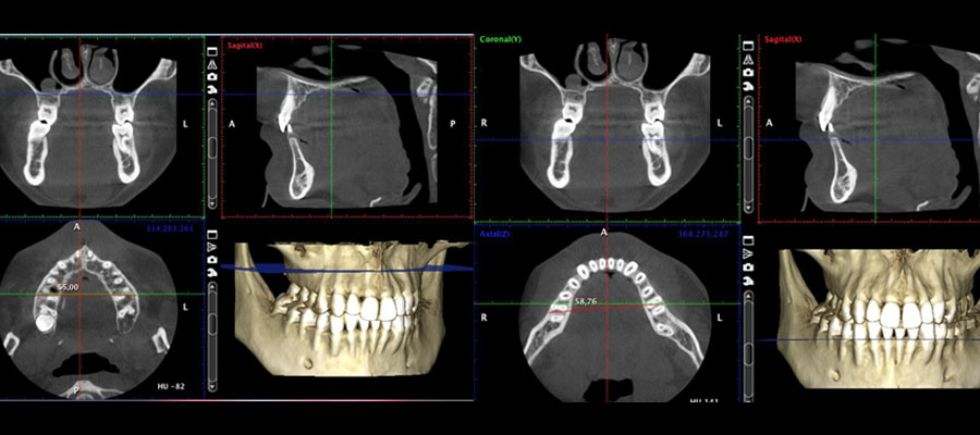 Imagen 3D ortodoncia